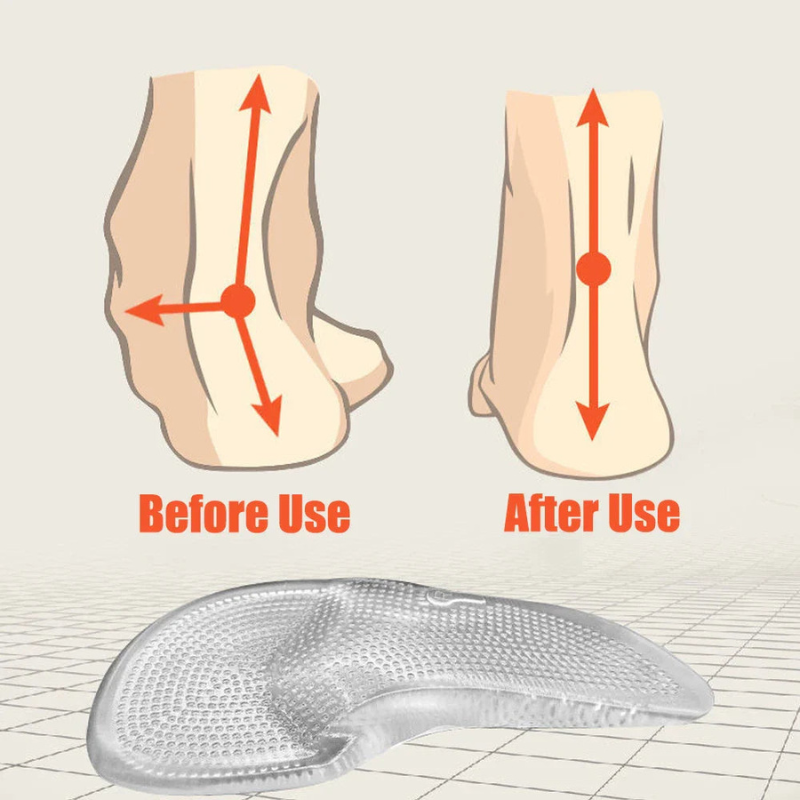Orthopedic Silicone Gel Insoles – Shock-Absorbing Arch Support